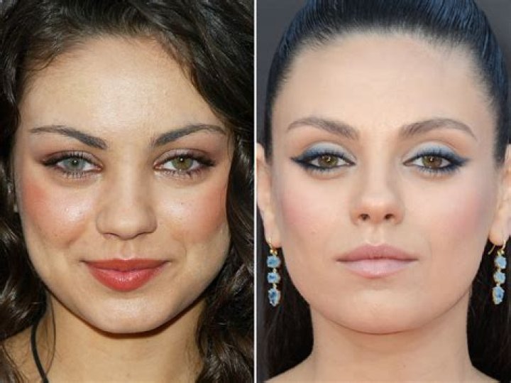 Did Mila Kunis Had Plastic Surgery On Cheetos Commercial? Before And After