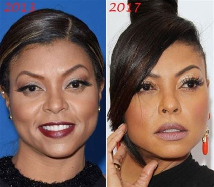 Did Taraji P Henson Had Nose Job? Plastic Surgery Details