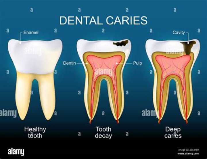 
How Did Erna Zahn Die? What Happened To Erna Zahn? Cause Of Death 