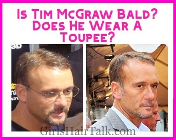 Is Tim McGraw Bald? Photos – Before And After, What Happened To His Hair?